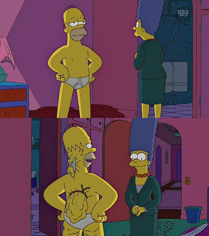 Gordura das Costas do Homer